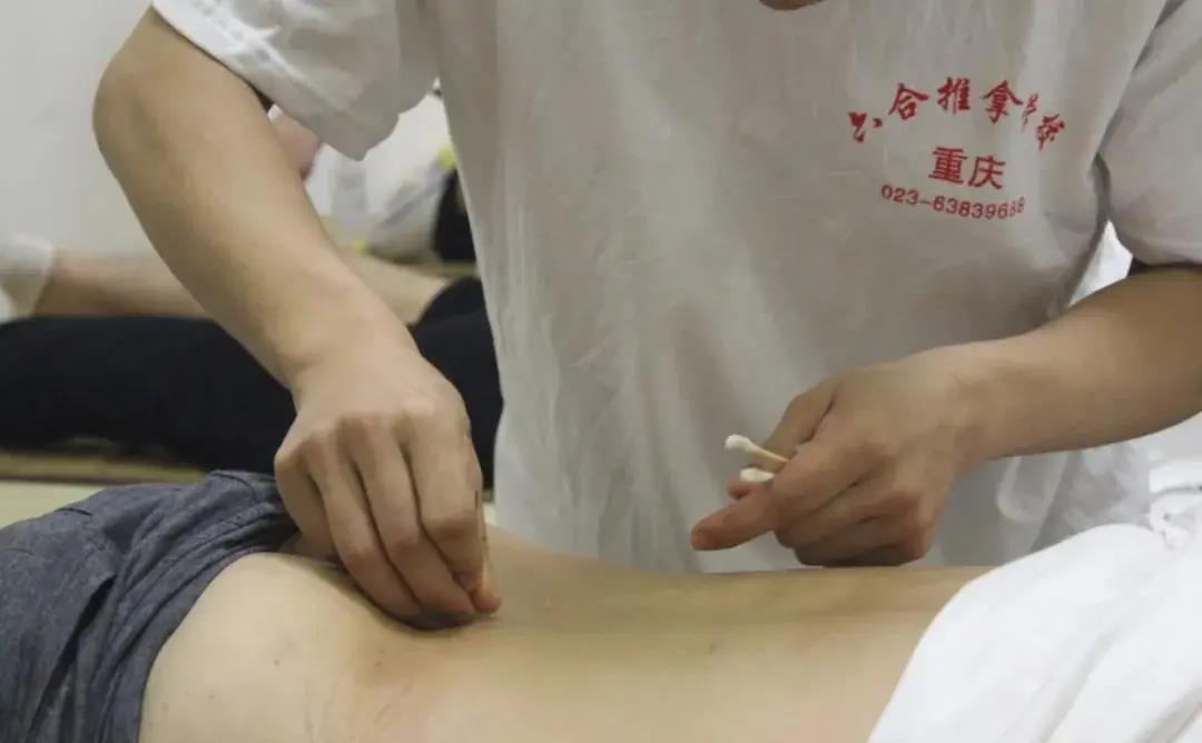 針灸真的很難嗎?一個月能學(xué)會針灸嗎?